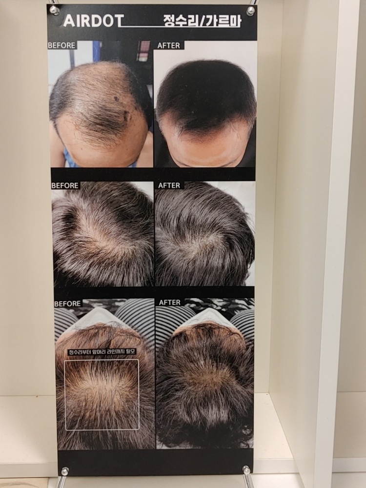 235149625_ciahkUtf_de4e5f7bd1a85ffa40a5dd6e634d56a9042eab1a.jpg 이미지크게보기